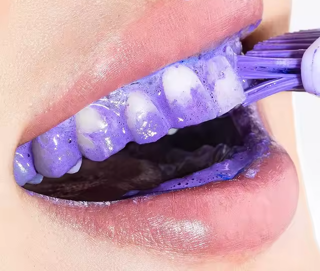 Primer plano de una boca con los dientes cubiertos de espuma morada mientras se cepilla.